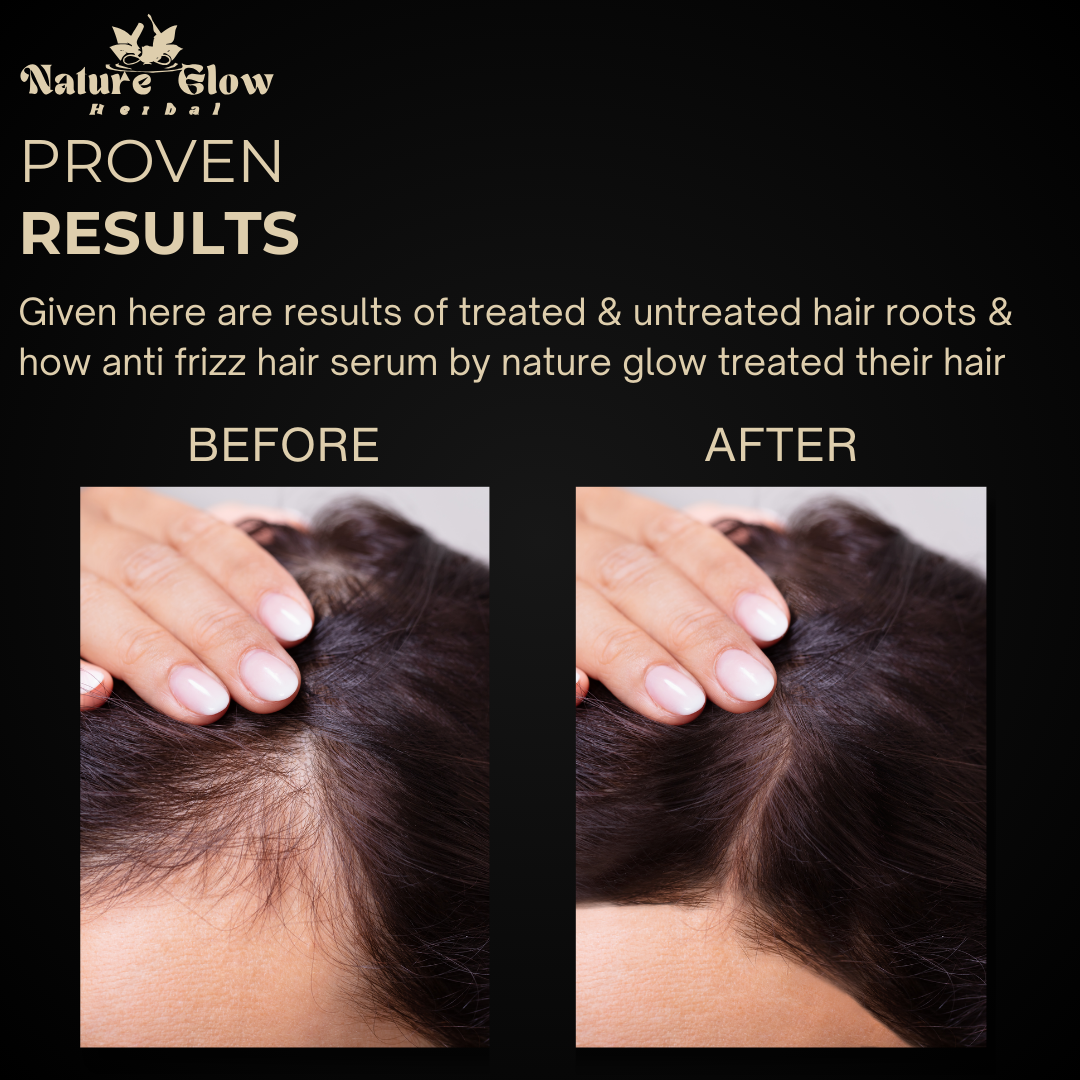 Nature Glow Anti Frizz Hair Serum